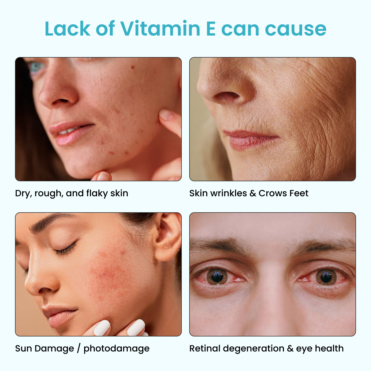 Vitamin E Clear Skin Mouth Spray