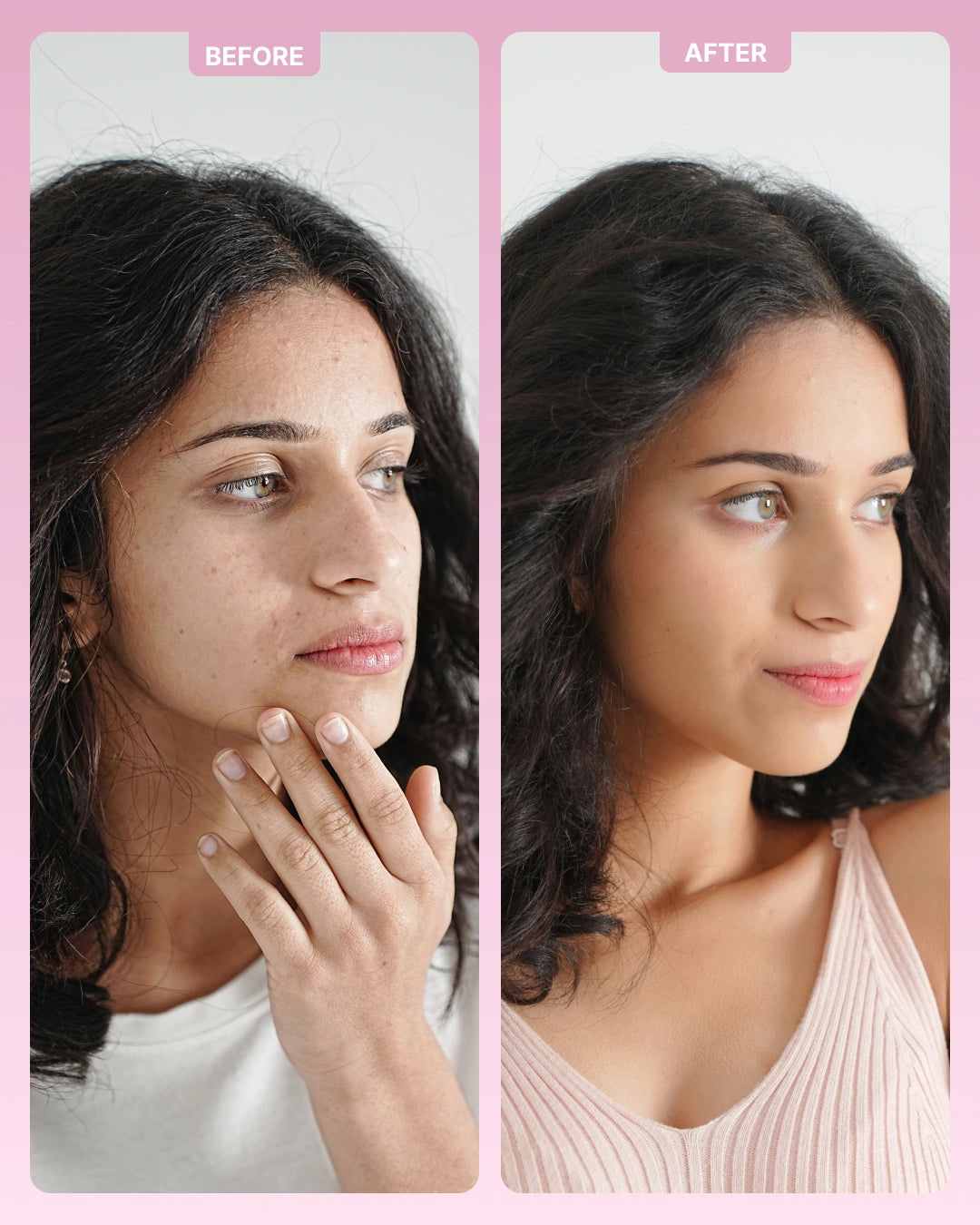 Intense Skin Brightening Glutathione-Mouthspray