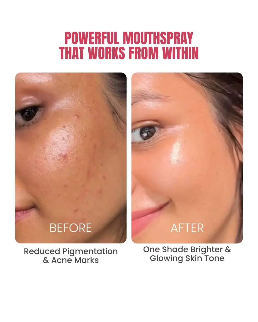 Intense Skin Brightening Glutathione-Mouthspray