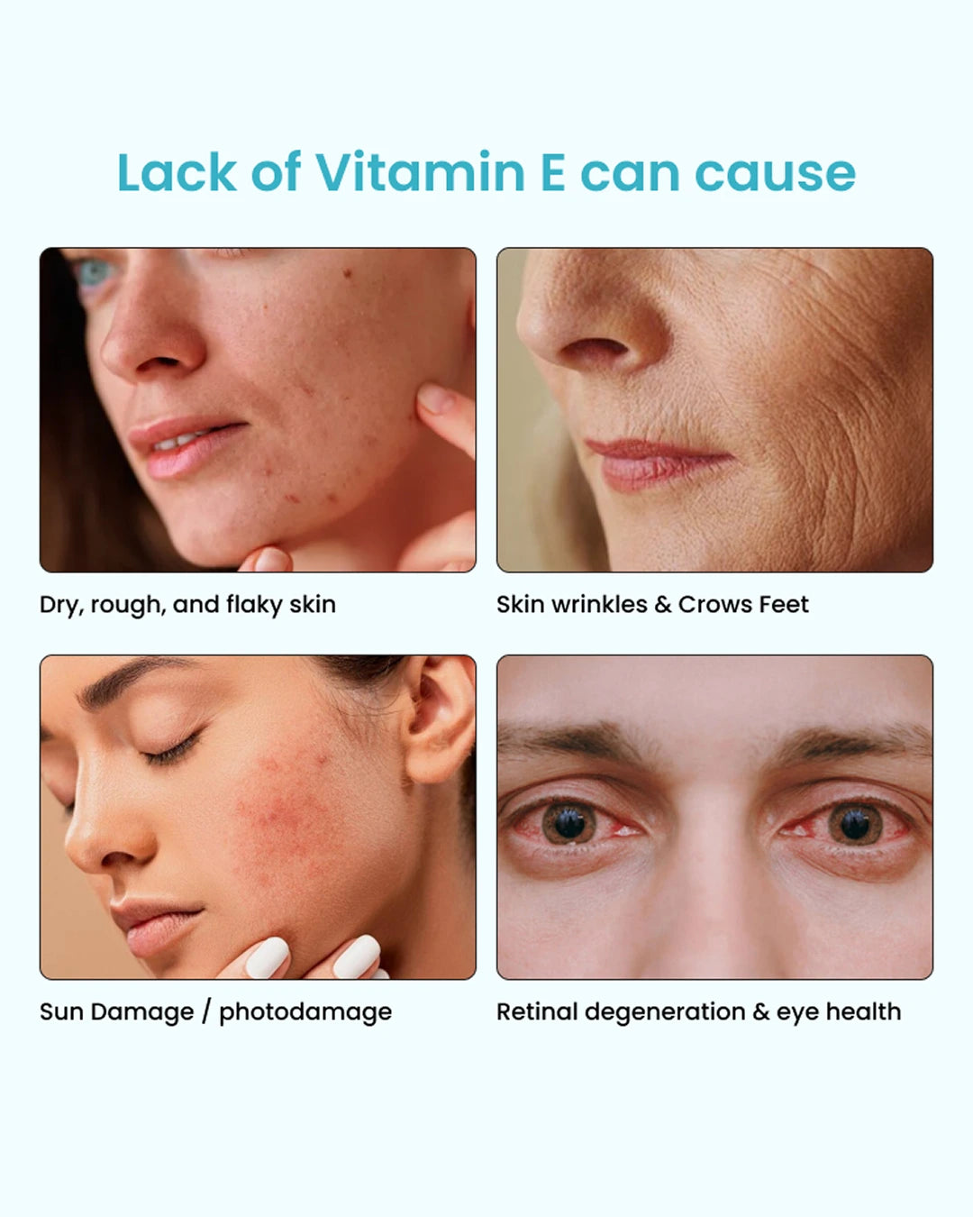 Vitamin E Clear Skin Mouth Spray