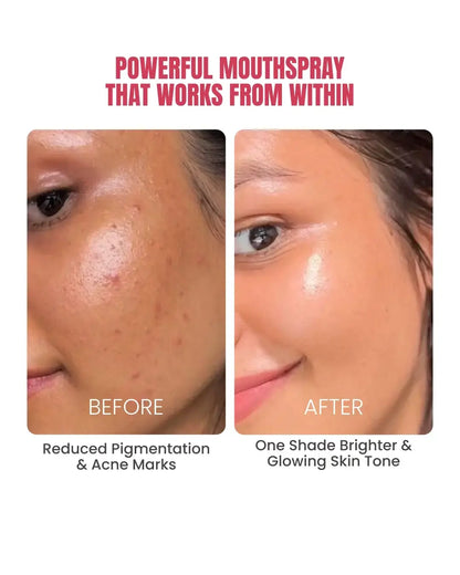 Intense Skin Brightening Glutathione-Mouthspray