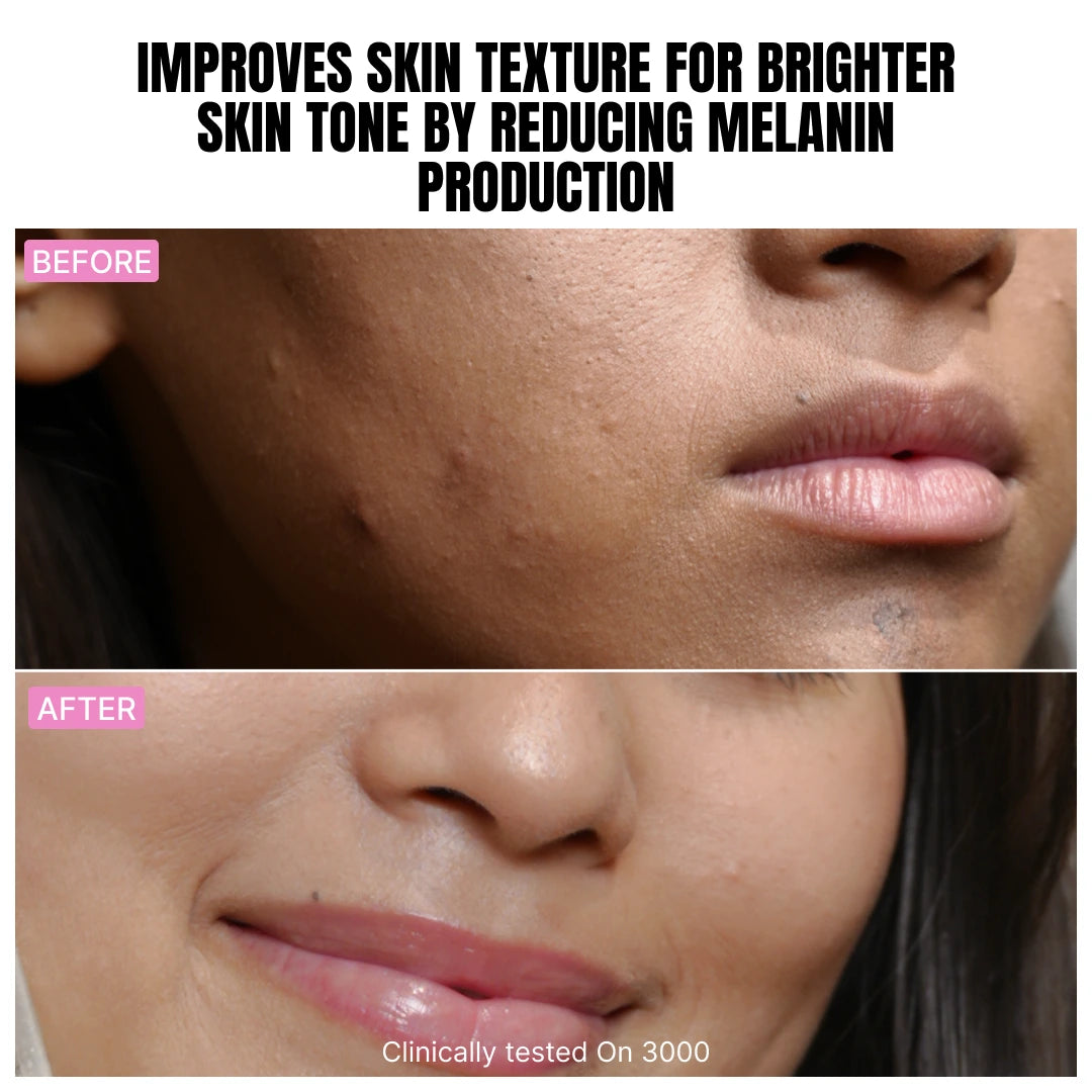 Gluta Glow Mouthspray