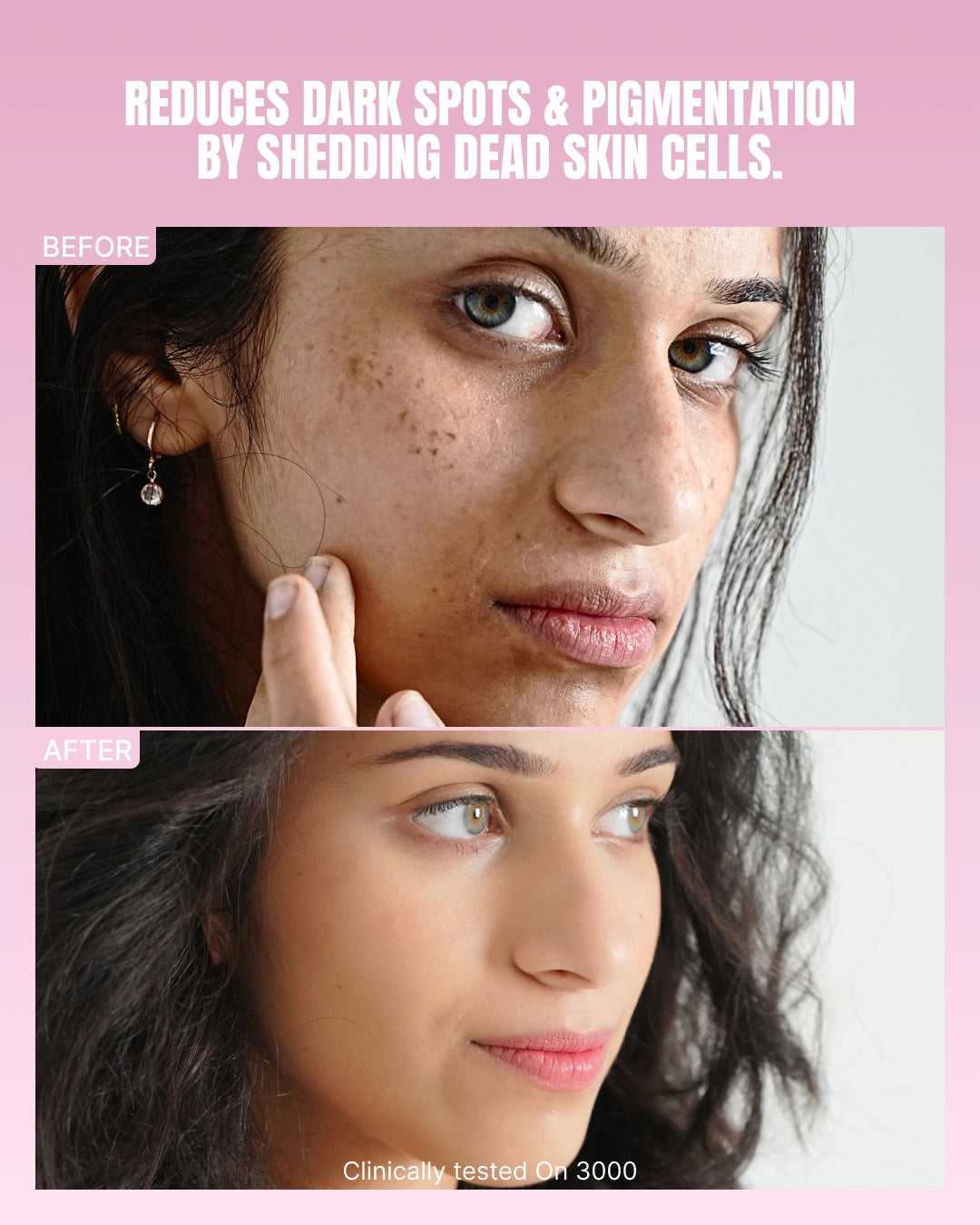 Intense Skin Brightening Glutathione-Mouthspray