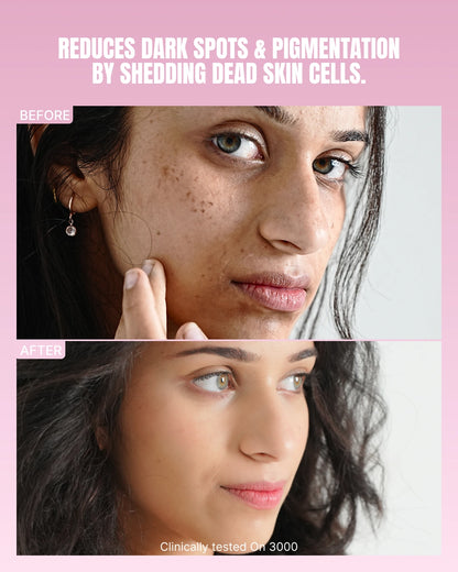 Intense Skin Brightening Glutathione-Mouthspray