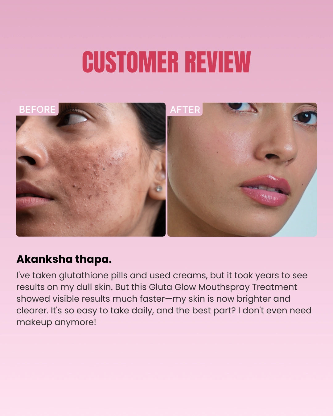 Intense Skin Brightening Glutathione-Mouthspray