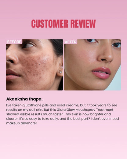 Intense Skin Brightening Glutathione-Mouthspray