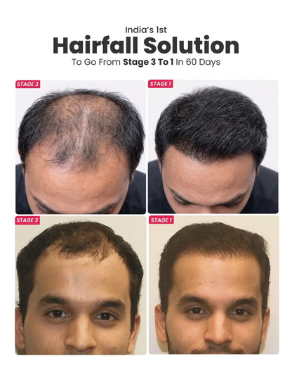 Biotin-Infused Hair Protein Mouthspray