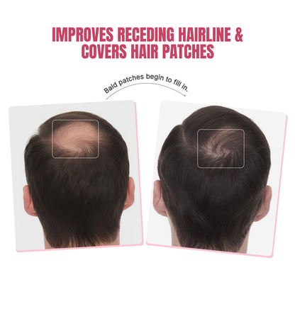 Biotin-Infused Hair Protein Mouthspray