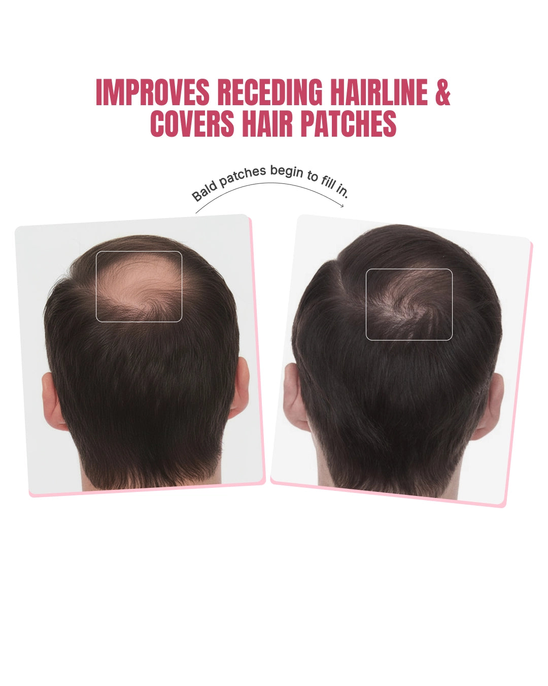 Biotin-Infused Hair Protein Mouthspray