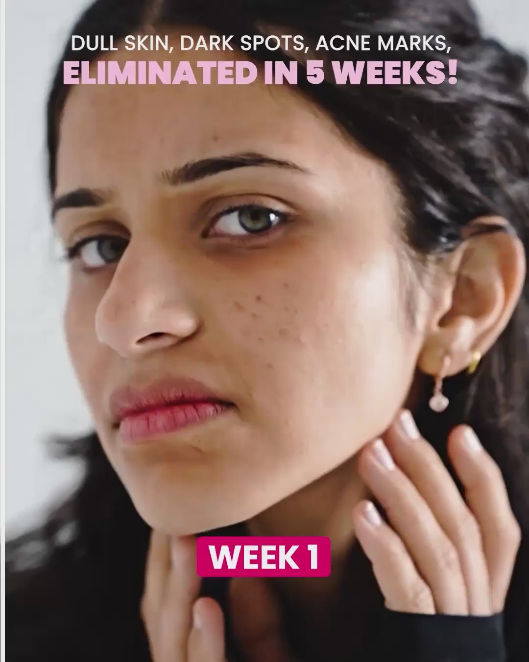 Load video: Intense Skin Brightening Glutathione-Mouthspray