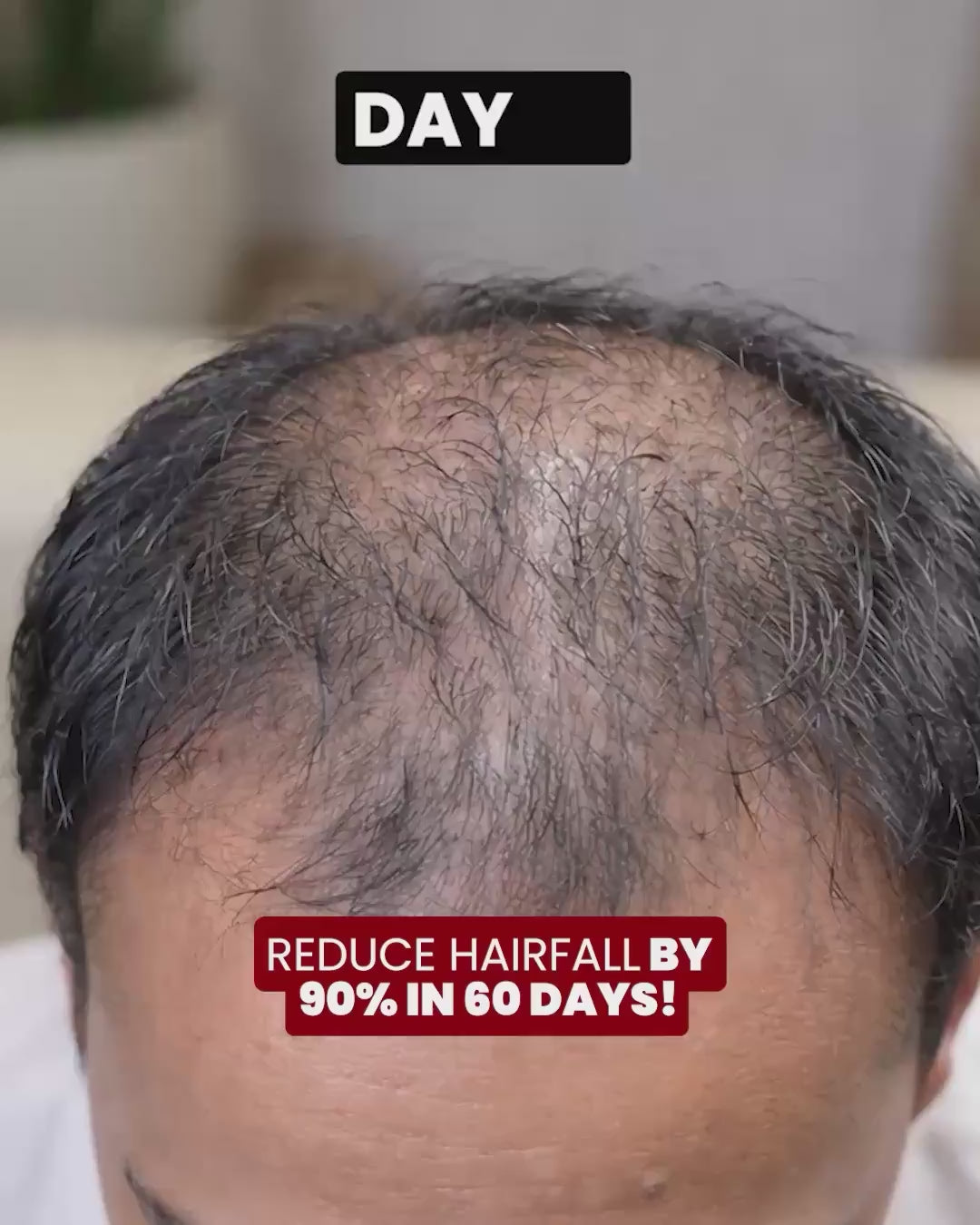 Load video: Biotin-Infused Hair Protein Mouthspray