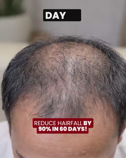 Biotin-Infused Hair Protein Mouthspray